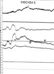 mos930709b.jpg