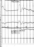 mos951101b.jpg