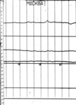 mos970103b.jpg